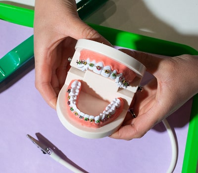Dental model with braces in hands