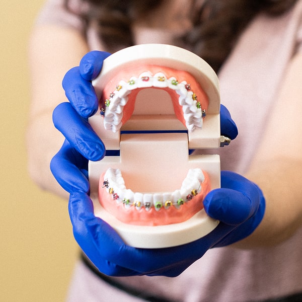 Dental model of a jaw with braces